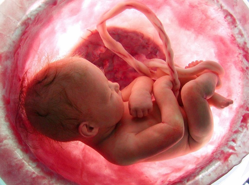 (Vidéo) L’infanticide par avortement en vérité